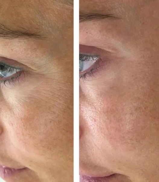 Гель для уменьшения темных кругов / Eye Brightening Gel (Opsis) / JULIETTE ARMAND купить