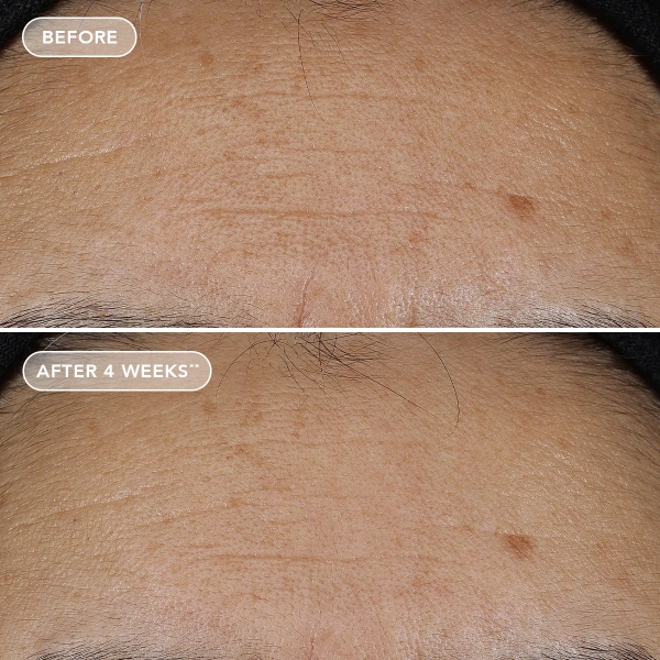 Крем, що відновлює, з ретиноловим комплексом 0.3% / Ageless+ Retinol Repair Crème 0.3% / Image Skincare купить