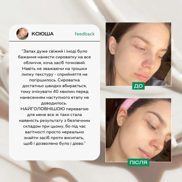 Сироватка для обличчя з проявами акне / "Siero per il viso con sintomi di acne" / Lamic Cosmetici купить