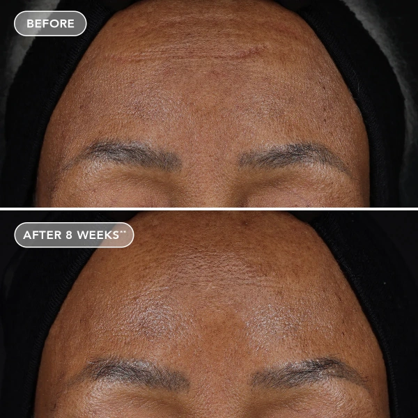 Усиленный крем с ретиноловым комплексом 1.2% / Ageless+ Retinol Treatment Crème 1.2% Retinol Complex / Image Skincare купить