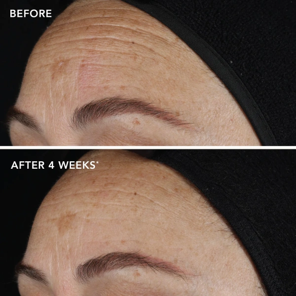 Концентрат чистого ретинола 0.75% / Ageless+ Retinol Pure Liquid Retinol 0.75% / Image Skincare купить