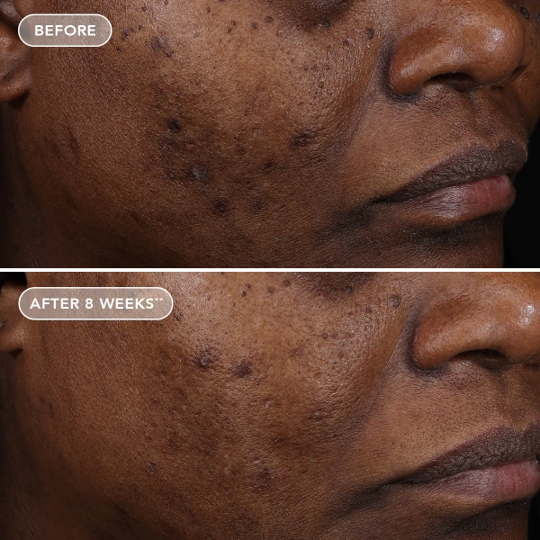 Усиленный крем с ретиноловым комплексом 1.2% / Ageless+ Retinol Treatment Crème 1.2% Retinol Complex / Image Skincare купить