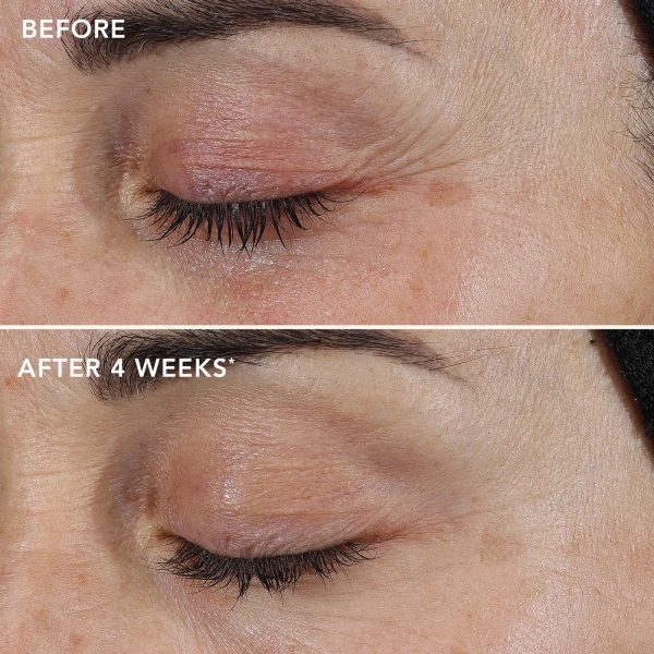 Восстанавливающий крем с ретиноловым комплексом 0.3% / Ageless+ Retinol Repair Crème 0.3% / Image Skincare купить