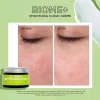 Увлажняющий крем-мусс со скваланом / Biome + Smoothing Cloud Cream / Image Skincare купить