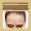 ПРОТИЗАПАЛЮВАЛЬНА СИВОРОТКА / ANTI-ACNE SERUM / Sanmarine купить