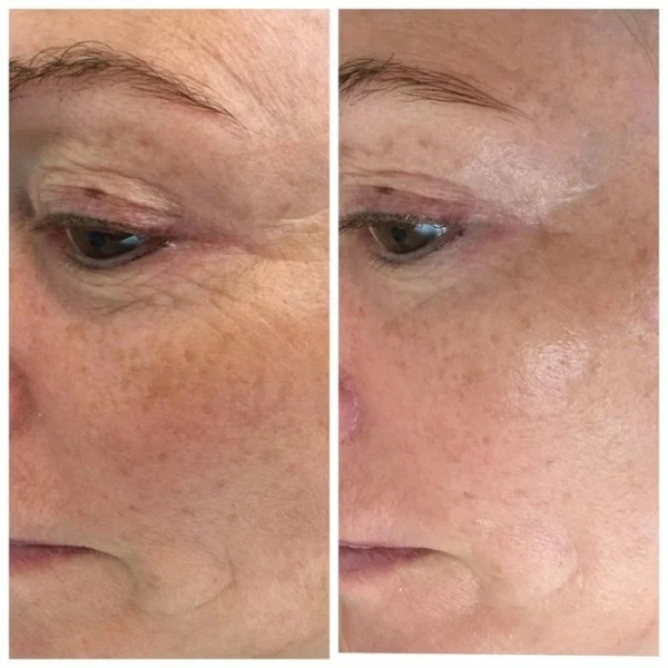 Крем для корекції мімічних зморшок / Hydra Lifting Cream (Thavma) / JULIETTE ARMAND купить