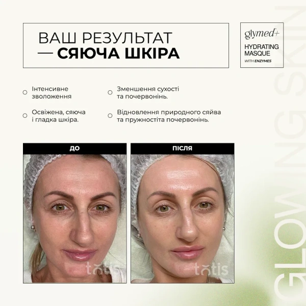 Ультразволожуюча маска з ензимами / Hydrating Masque with Enzymes / GlyMed Plus купить