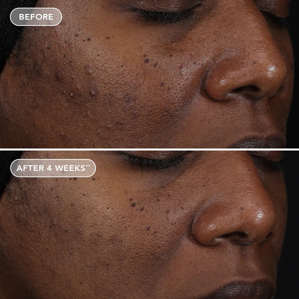 Крем, що відновлює, з ретиноловим комплексом 0.3% / Ageless+ Retinol Repair Crème 0.3% / Image Skincare купить