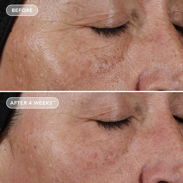 Концентрат чистого ретинола 0.75% / Ageless+ Retinol Pure Liquid Retinol 0.75% / Image Skincare купить