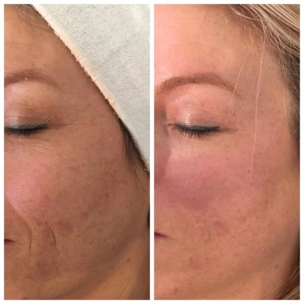 Крем для коррекции мимических морщин / Hydra Lifting Cream (Thavma) / JULIETTE ARMAND купить