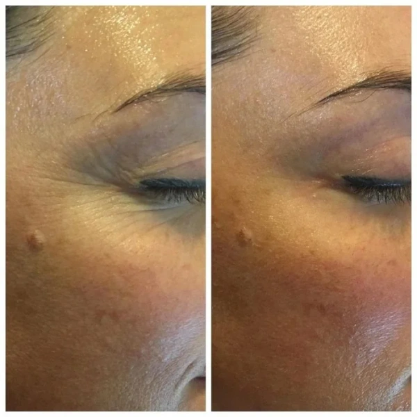 Гель для зменшення темних кіл / Eye Brightening Gel (Opsis) / JULIETTE ARMAND купить