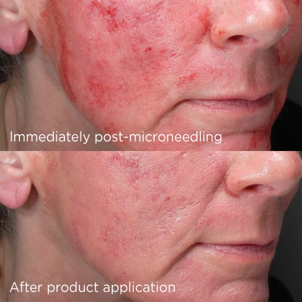 Усиленный минеральный увлажняющий крем SPF 50+ / Daily Prevention Advanced Smartblend Mineral Moisturizer SPF 50+ / Image Skincare  купить