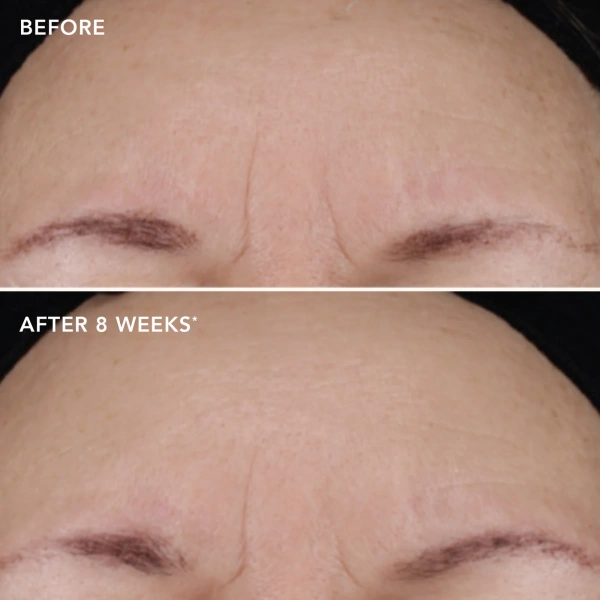 Усиленный крем с ретиноловым комплексом 1.2% / Ageless+ Retinol Treatment Crème 1.2% Retinol Complex / Image Skincare купить