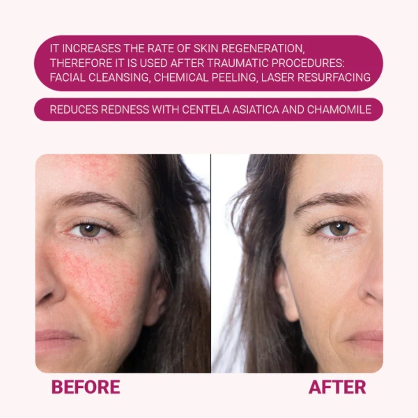 Успокаивающий гель с центеллой / CENTELLA SERUM / Sanmarine купить