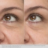 Разглаживающий крем-гель для глаз / Rejuvenating Eye Gel Cream / Obagi Medical купить