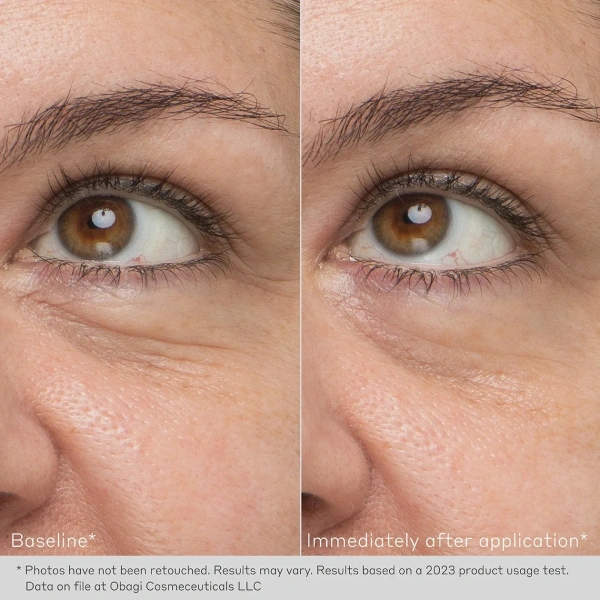 Розгладжуючий крем-гель для очей / Rejuvenating Eye Gel Cream / Obagi Medical купить