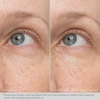 Разглаживающий крем-гель для глаз / Rejuvenating Eye Gel Cream / Obagi Medical купить