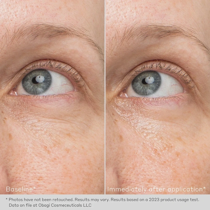 Разглаживающий крем-гель для глаз / Rejuvenating Eye Gel Cream / Obagi Medical купить