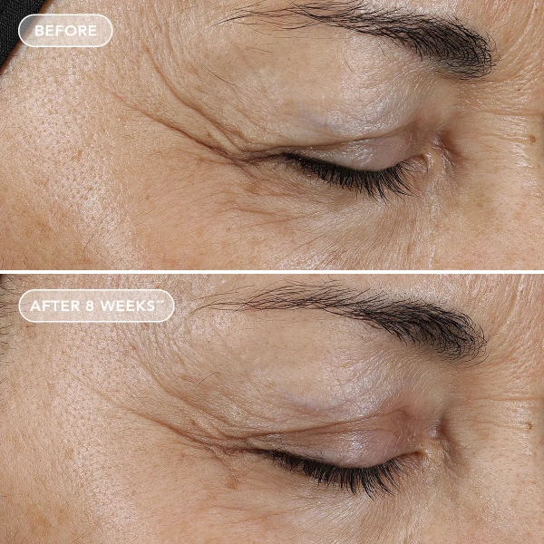 Восстановительная маска с ретиноловым комплексом 0,5% / Ageless+ Retinol Overnight Masque 0.5% Retinol Complex / Image Skincare купить