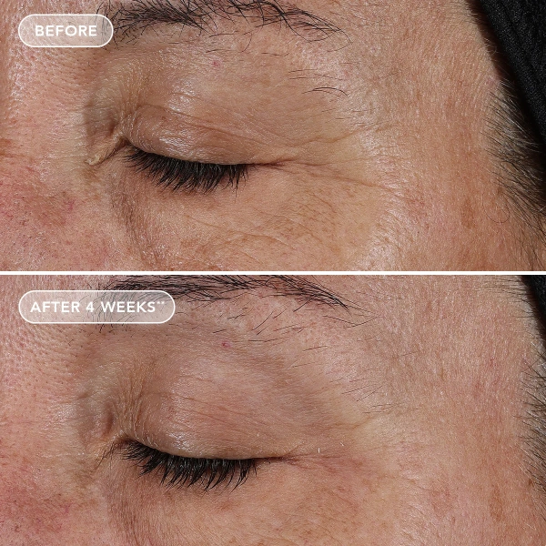 Концентрат чистого ретинола 0.75% / Ageless+ Retinol Pure Liquid Retinol 0.75% / Image Skincare купить