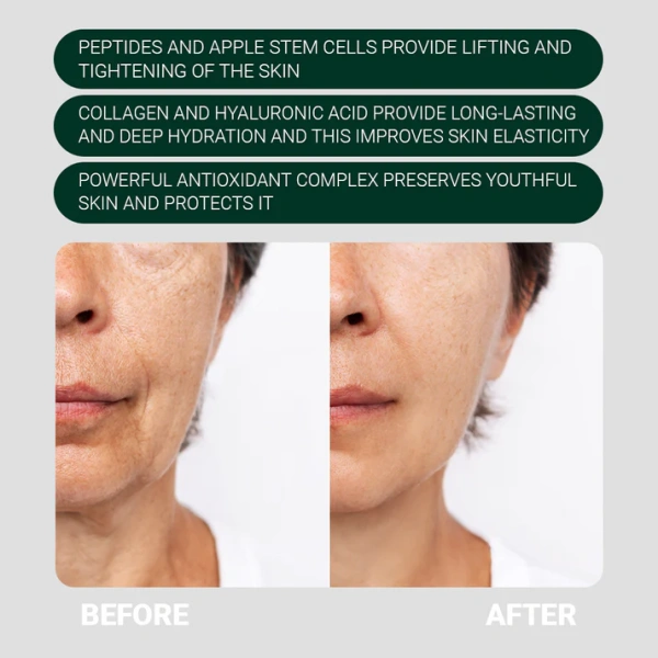 КРЕМ ДЛЯ ОБЛИЧЧЯ З СТВОЛОВИМИ КЛІТИНАМИ ЯБЛУКА / FACE CREAM WITH APPLE STEM CELLS / Sanmarine / Sanmarine купить