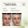 Ультраувлажняющая маска с энзимами / Hydrating Masque with Enzymes / GlyMed Plus купить