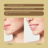 Себорегулирующий крем / ANTI-ACNE CREAM / Sanmarine купить