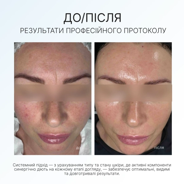 Сироватка з трьома видами вітаміну C / SMART C FACE SERUM / AG Skin купить