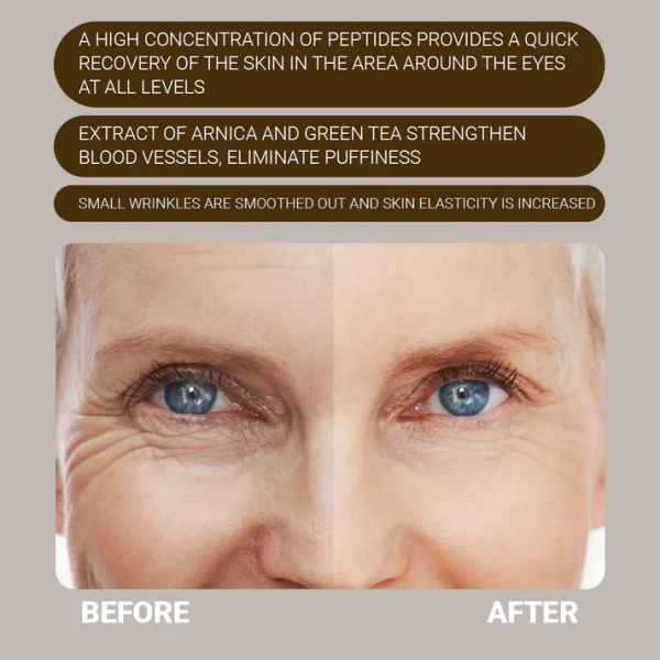 Поліпептидний крем для контуру очей / POLYPEPTIDE EYE CREAM / Sanmarine купить