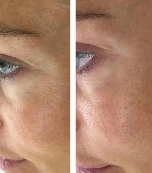 Гель для зменшення темних кіл / Eye Brightening Gel (Opsis) / JULIETTE ARMAND купить